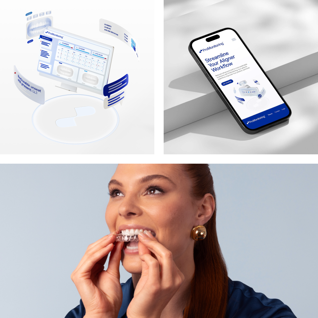 Glidewell ProMonitoring app and clear aligner treatment