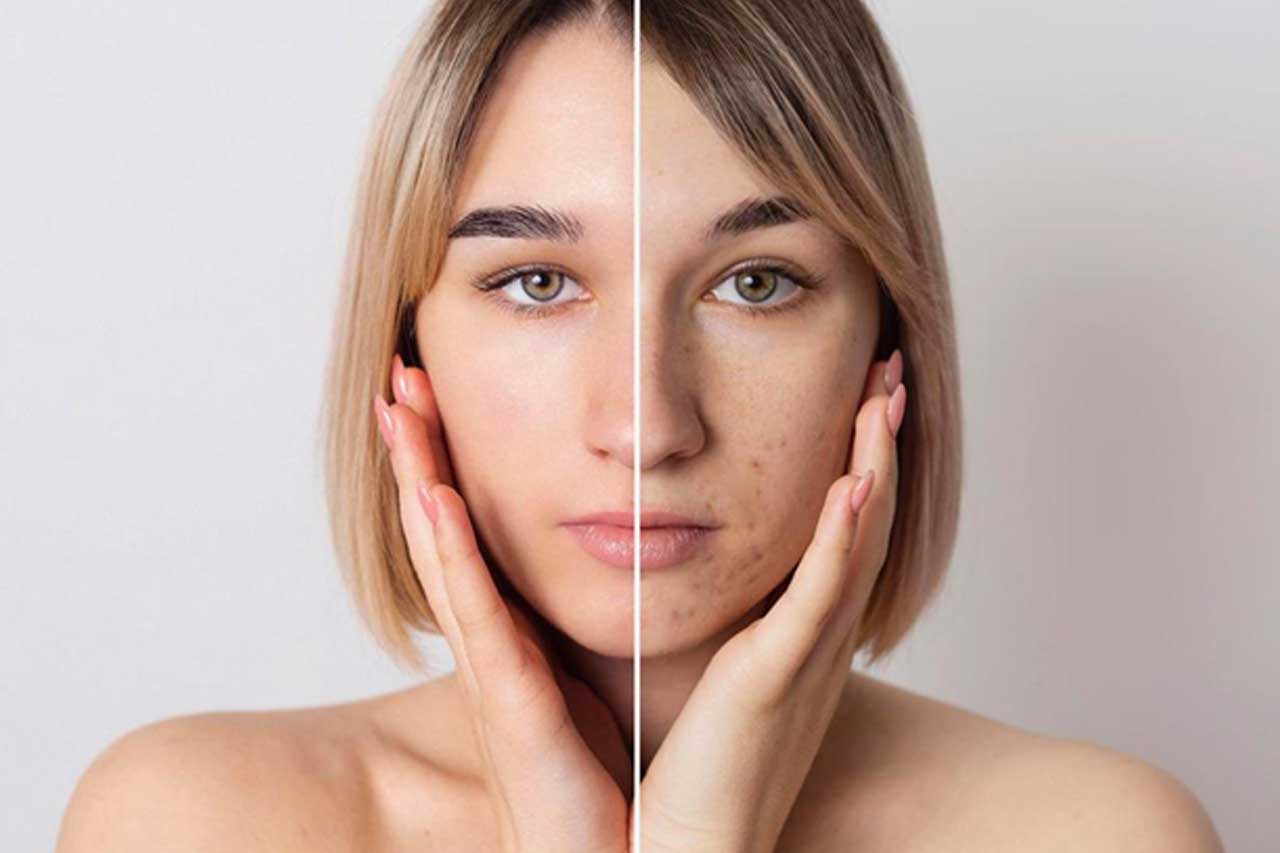 Skin treatment before and after results