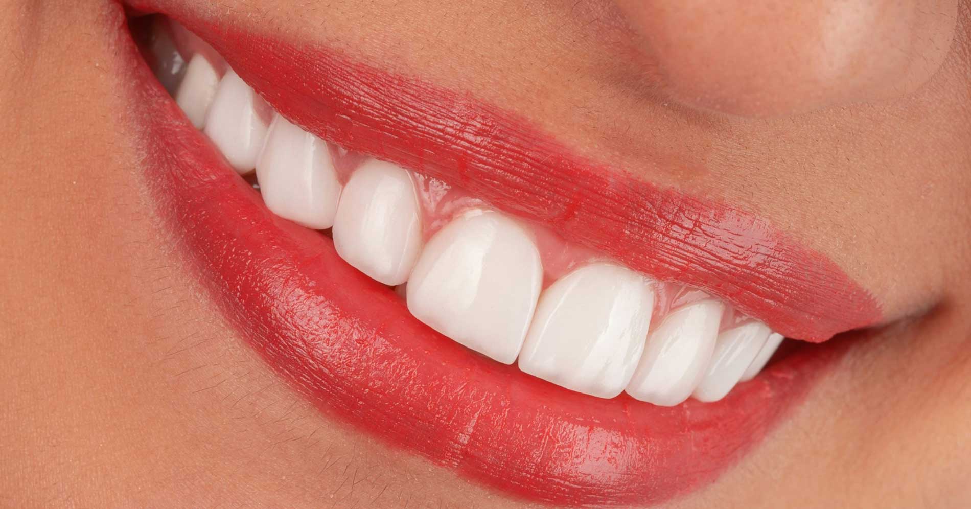 Preventive dental cleaning